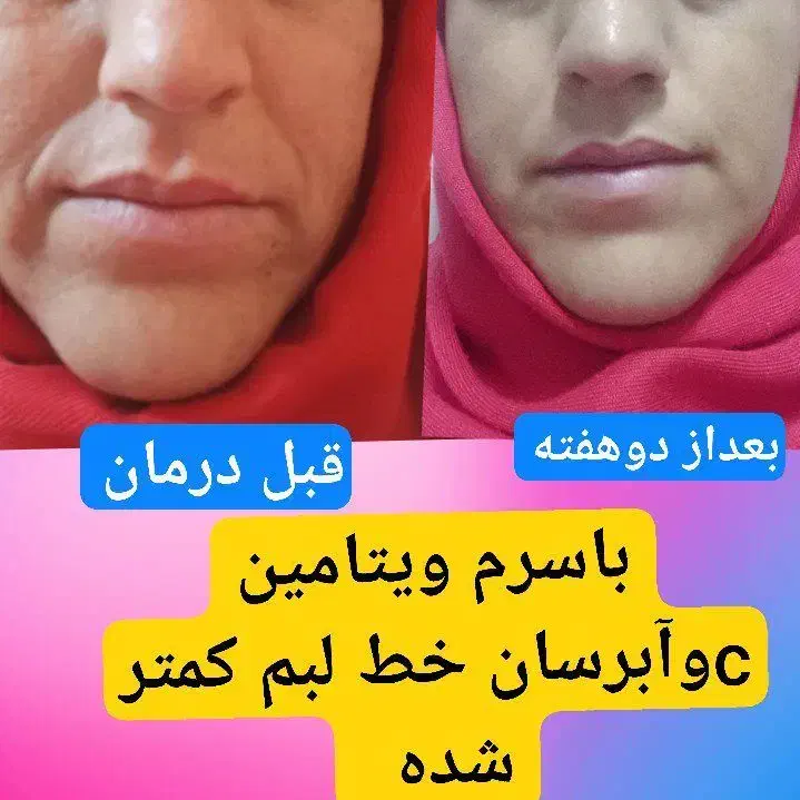 سرم ویتامین Cآریا|آرایشی، بهداشتی، درمانی|تهران, محمودیه|دیوار
