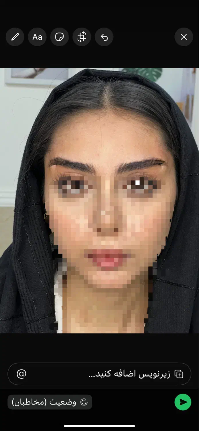 بوتاکس خطوط پیشانی و اخم رایگان‌ شد|خدمات آرایشگری و زیبایی|قم, هفت تیر|دیوار