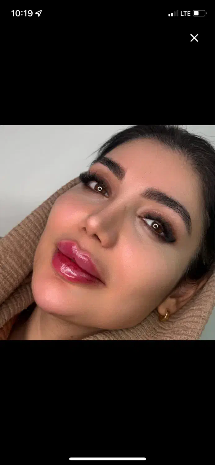 کلینیک پوست زیبایی تزریق ژل390مزوprp لیزر لاغری|خدمات آرایشگری و زیبایی|تهران, ستارخان|دیوار