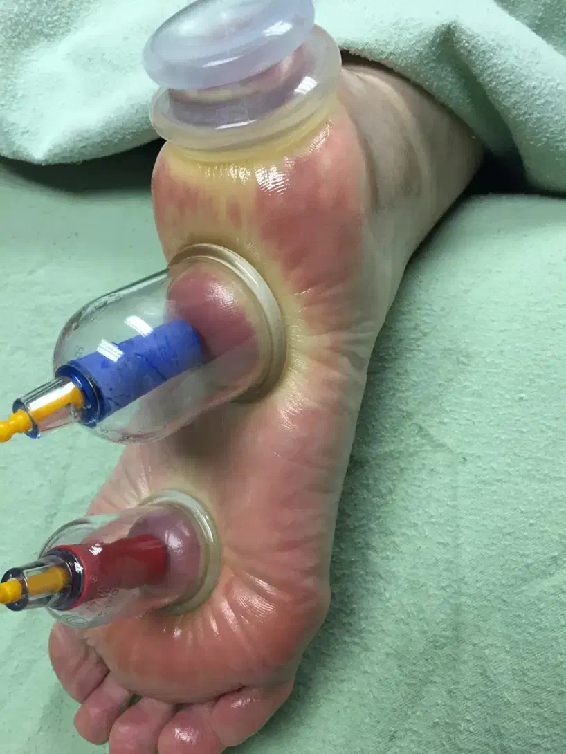 بادکش گرم و آگنی کارما.|خدمات آرایشگری و زیبایی|تهران, بهارستان|دیوار