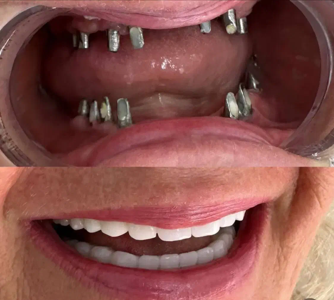 دندانپزشکی مرکز تخصصی ایمپلنت در تبریز|خدمات آرایشگری و زیبایی|مرند, |دیوار