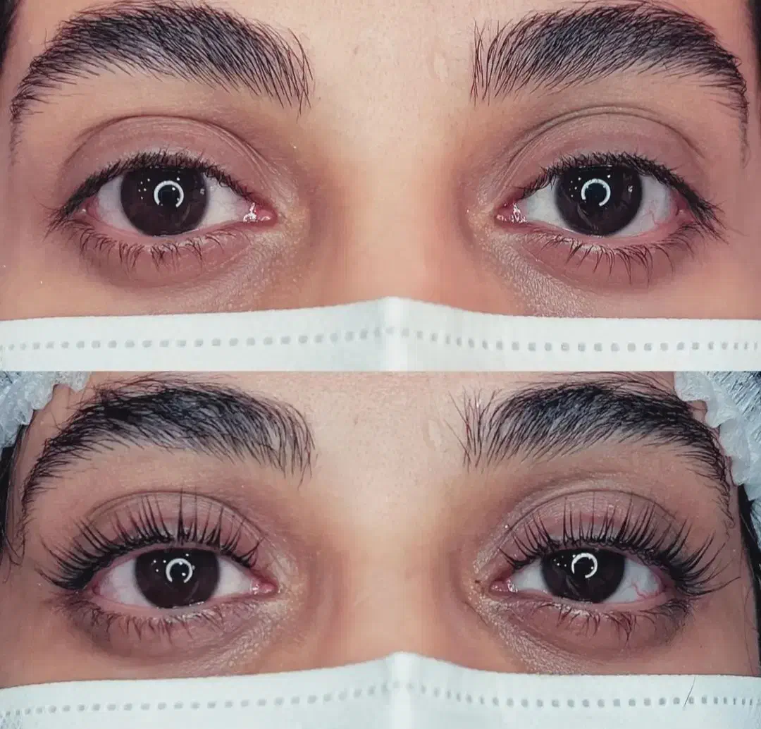 مدل کاشت و لیفت|خدمات آرایشگری و زیبایی|خرم‌آباد, |دیوار