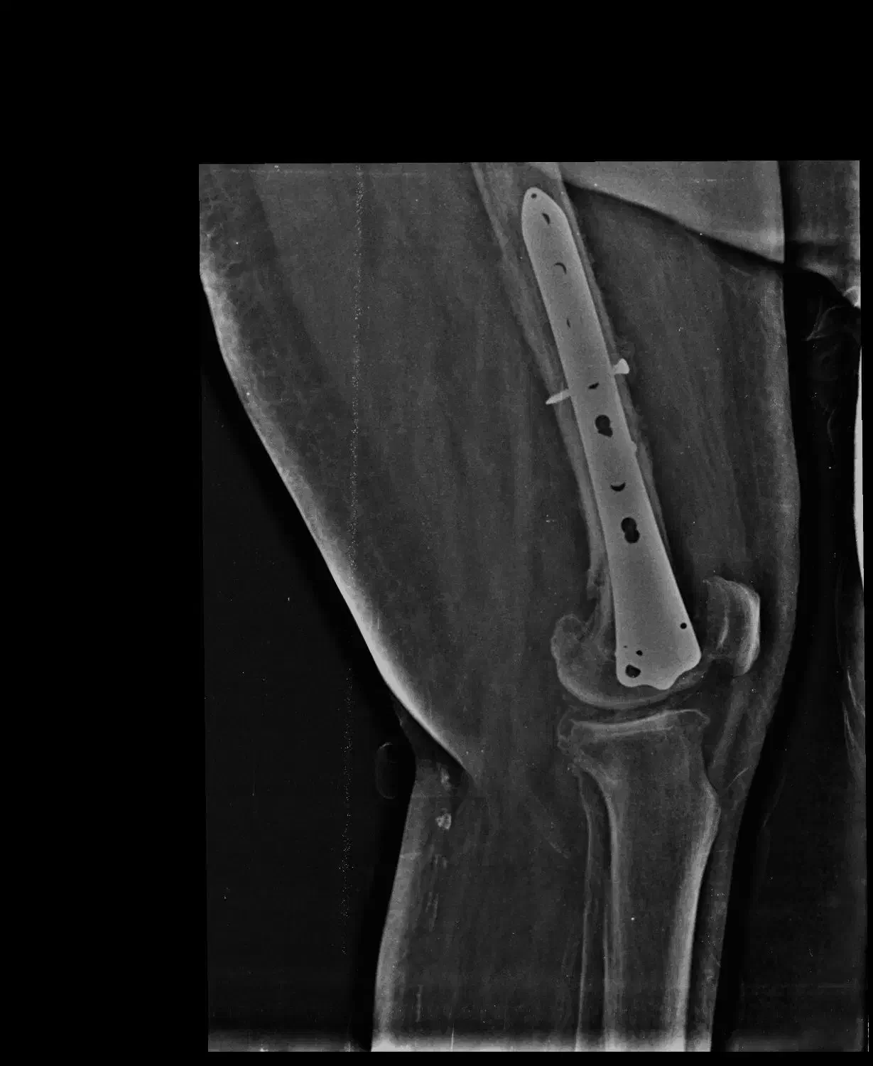 عکس رادیولوژی در منزل|پزشکی|تهران, پاسداران|دیوار