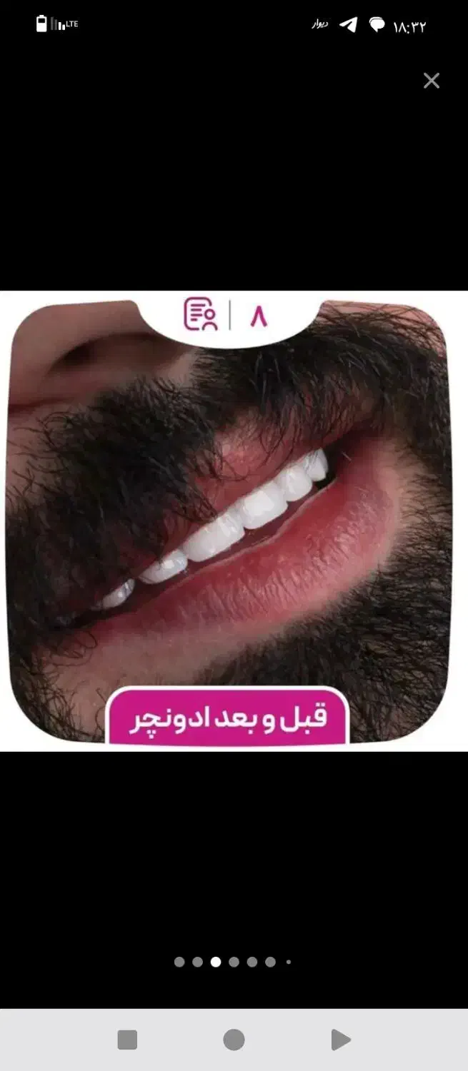 مرکزفوق تخصصی ایمپلنت دیجیتال/ایمپلنت فوری/بی درد|خدمات آرایشگری و زیبایی|مشهد, کوه سنگی|دیوار
