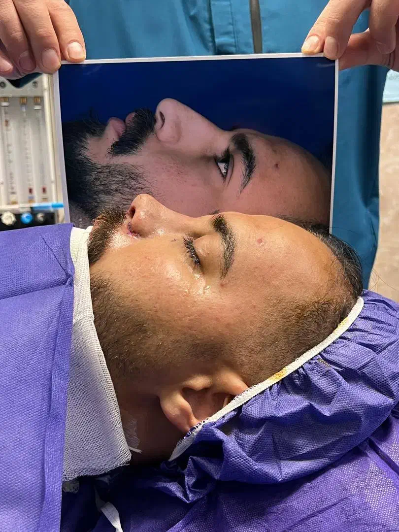 با ۲۶ تومن بینیتو عمل کن|خدمات آرایشگری و زیبایی|اصفهان, شاهد|دیوار