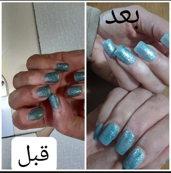 درمان معجزه گر|آرایشی، بهداشتی، درمانی|شاهینشهر, فردوسی|دیوار