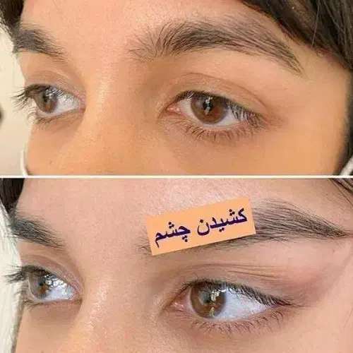 اصل چسب لیفت صورت وشقیقه|آرایشی، بهداشتی، درمانی|تربت جام, المهدی|دیوار