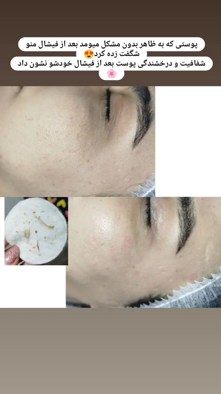 پاکسازی وفیشال|خدمات آرایشگری و زیبایی|شهریار, شهریار|دیوار