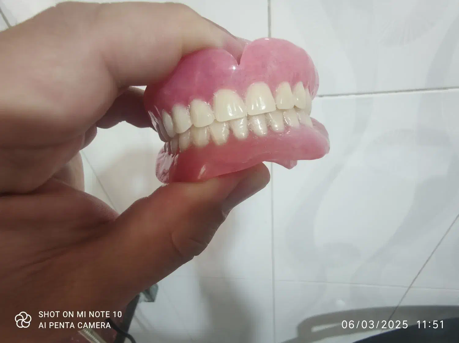 ساخت انواع دندان های مصنوعی متحرک و لثه ژله ای|آرایشی، بهداشتی، درمانی|شیراز, اصلاح‌نژاد|دیوار