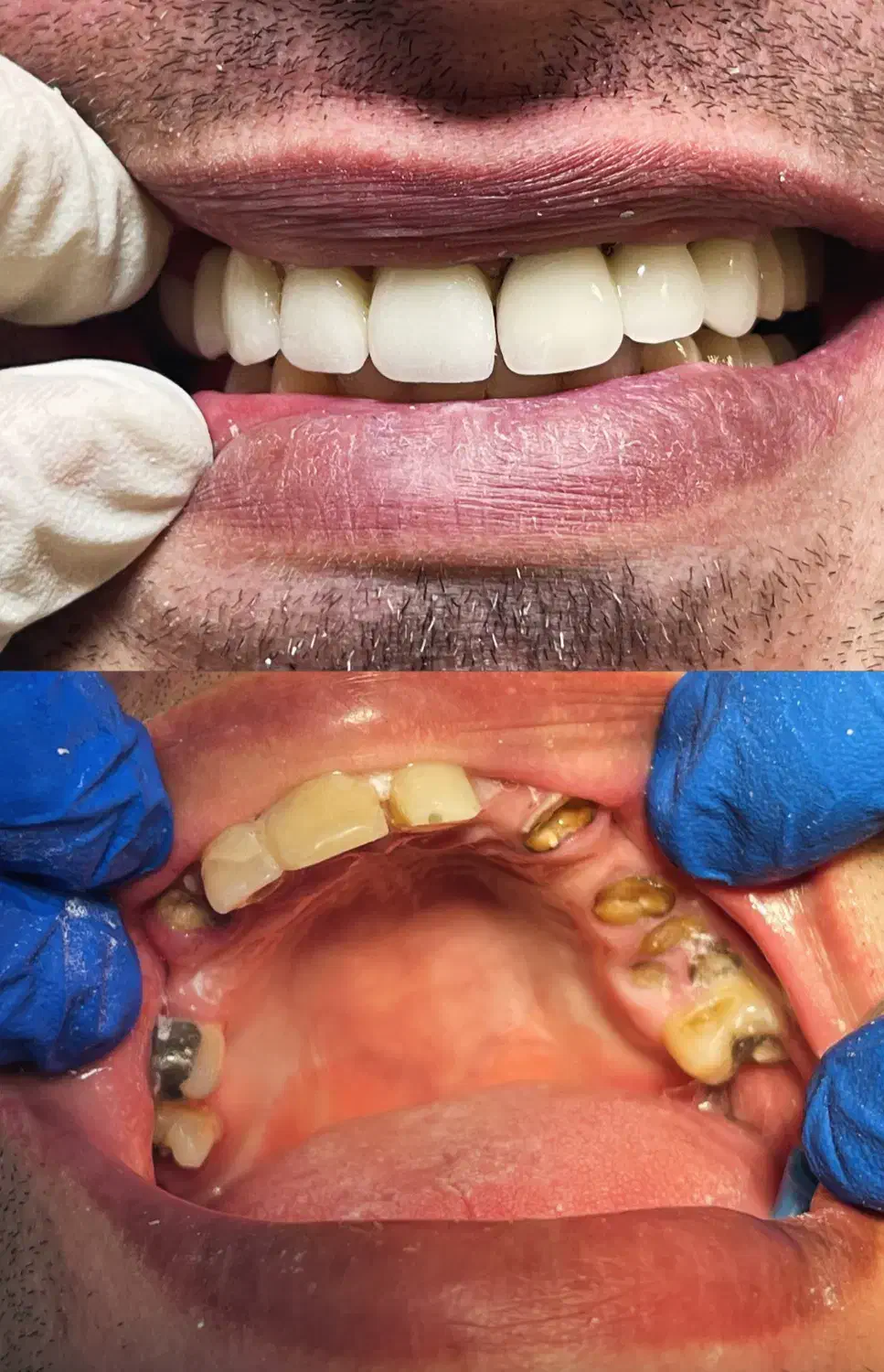 دندانپزشکی در آخونی|خدمات آرایشگری و زیبایی|تبریز, |دیوار