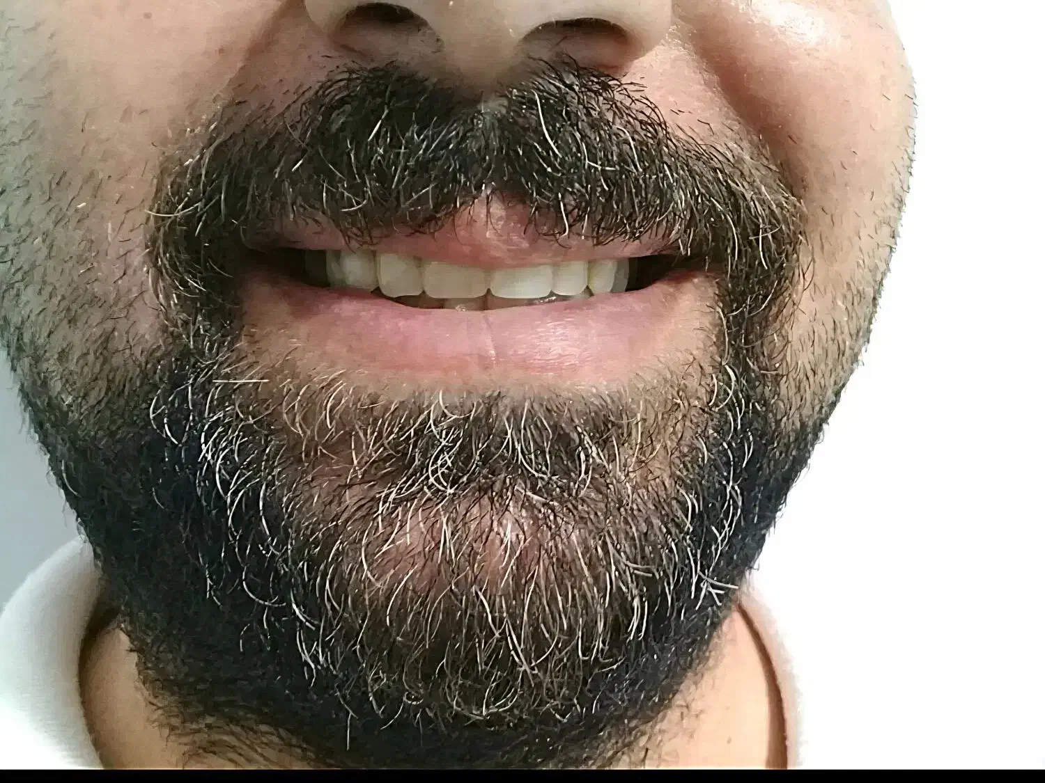 دندان کامل(شرایطی ویژه)|خدمات آرایشگری و زیبایی|سلطانیه, |دیوار