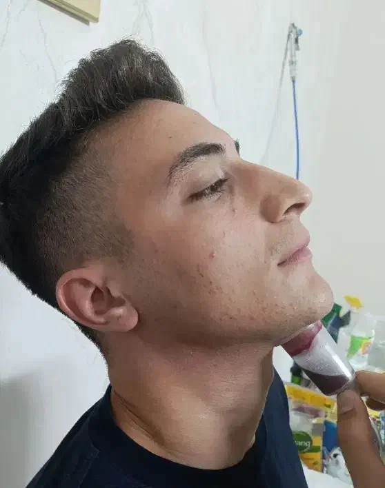 مشاوره حجامت و بادکش گرم زالو فصد خون امبدینگ|خدمات آرایشگری و زیبایی|اصفهان, بهارستان (مخابرات)|دیوار