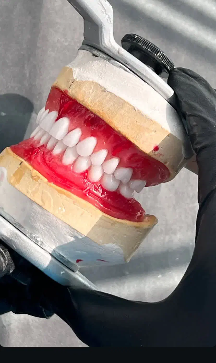 دست دندان مصنوعی( پروتز متحرک)|خدمات آرایشگری و زیبایی|ارومیه, |دیوار