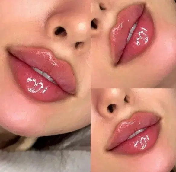 جشنواره 2روزه ژل وبوتاکس آنزیم ومزو|خدمات زیبایی و سلامت|مشهد, طلاب|دیوار
