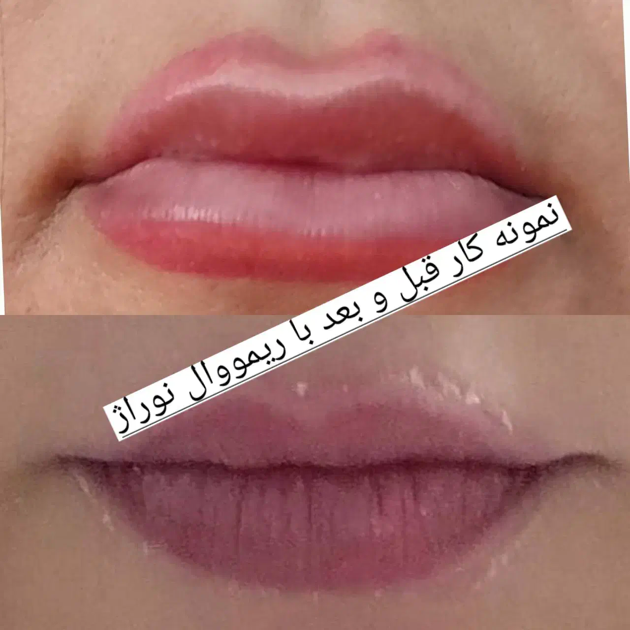 تخفیف ریمو تتو به مدت محدود|خدمات آرایشگری و زیبایی|تهران, تهرانپارس غربی|دیوار