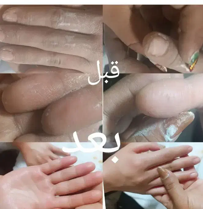 تخفیف ویژه پارافین تراپی دست و پا همراه کف سابی پا|خدمات آرایشگری و زیبایی|یزد, |دیوار