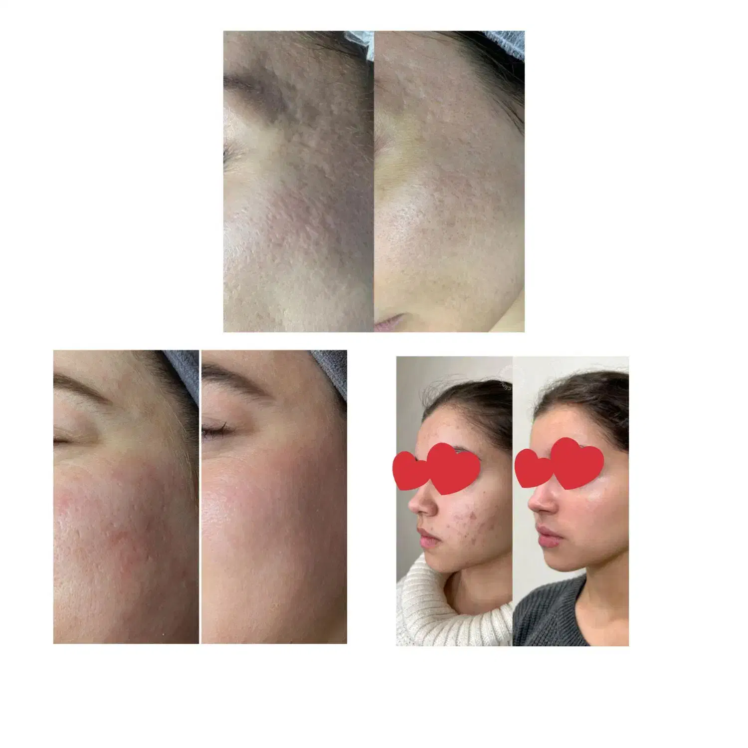 خدمات پوست و مو|خدمات آرایشگری و زیبایی|مراغه, |دیوار