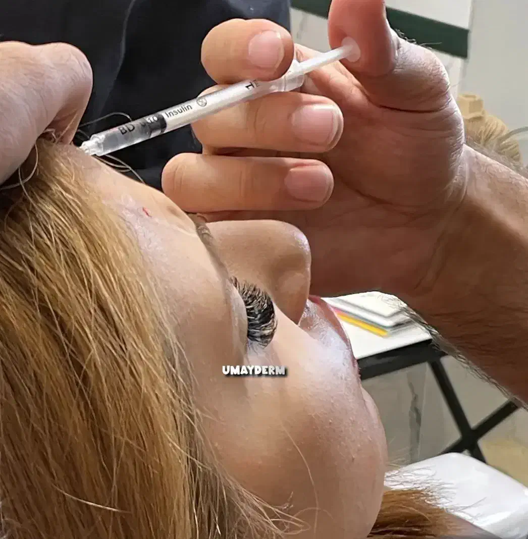 جشنواره بوتاکس|خدمات آرایشگری و زیبایی|اردبیل, |دیوار