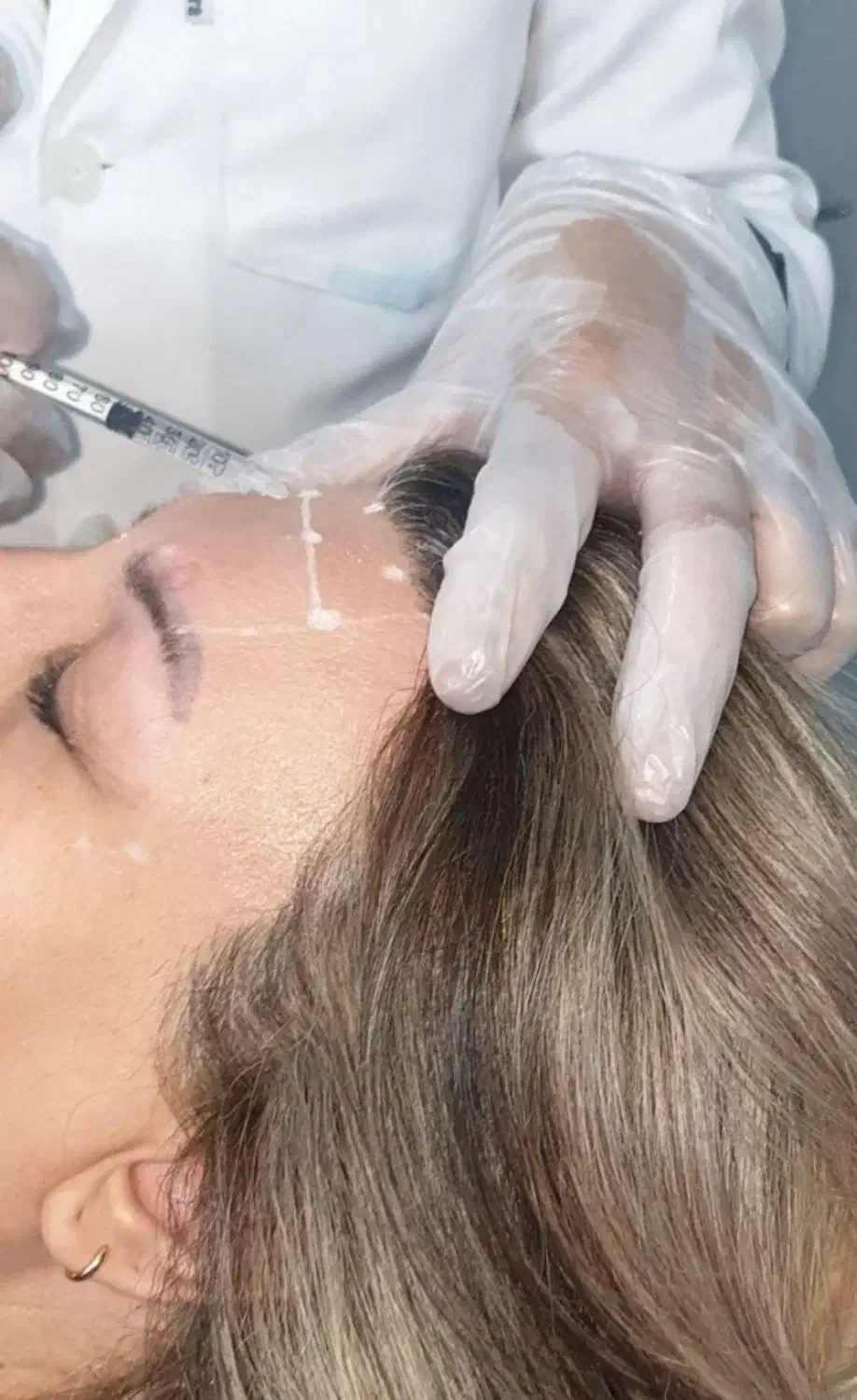 جشنواره فیلر بادی بدن باسن ممنوعه دست پا سی سی۱۸۰|خدمات آرایشگری و زیبایی|شیراز, شریفآباد|دیوار