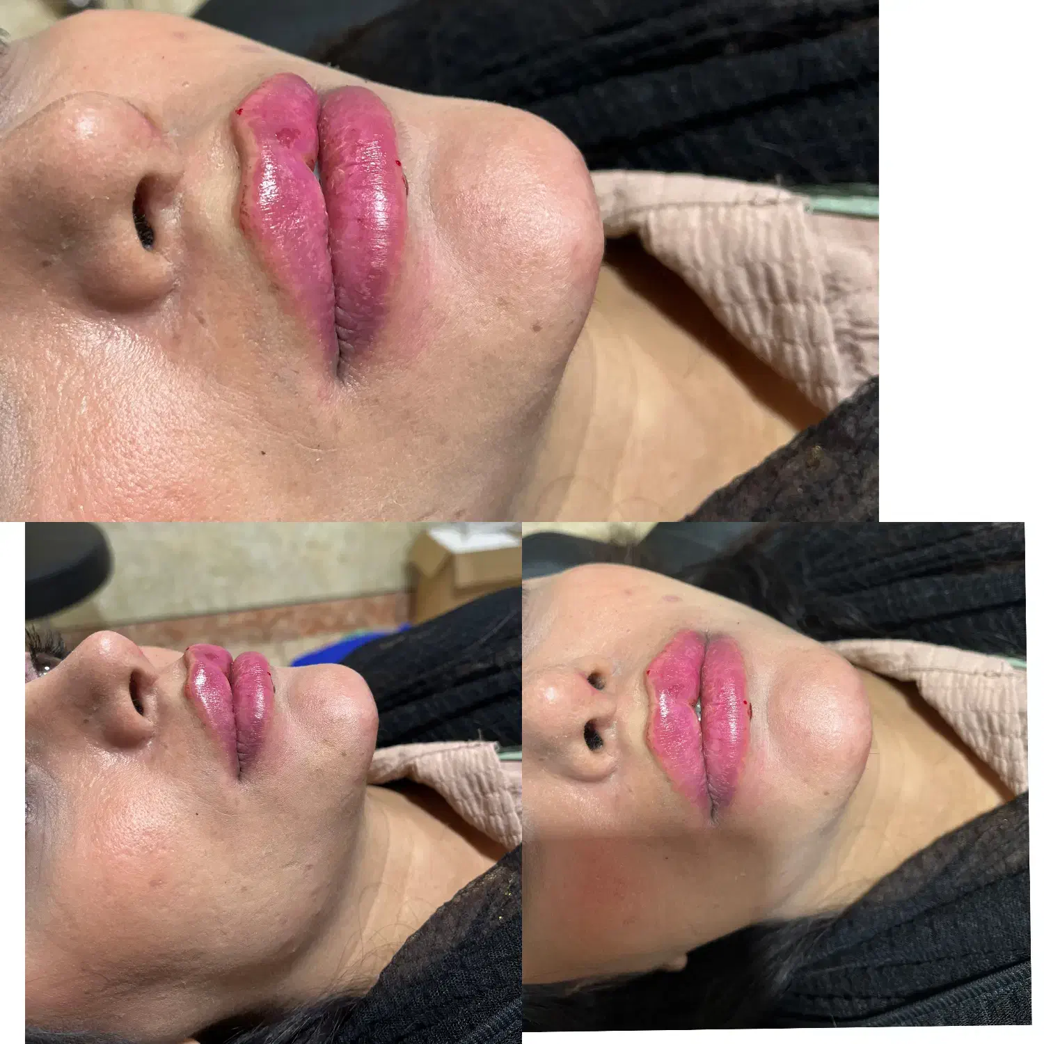 ژل بوتاکس|خدمات آرایشگری و زیبایی|دورود, |دیوار