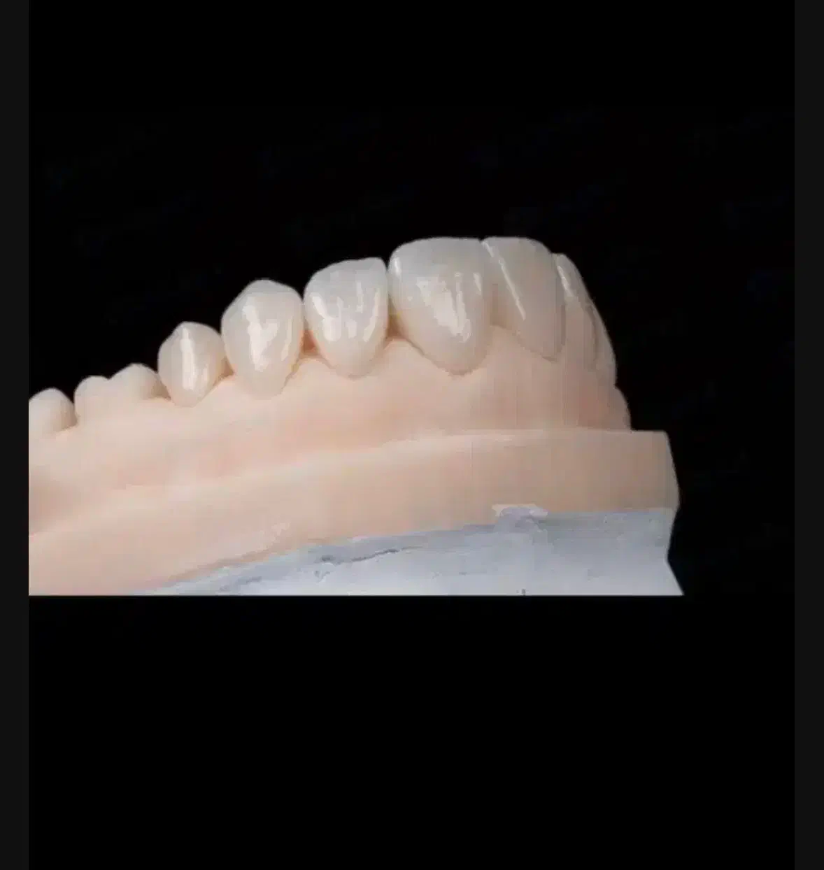 دندانسازی|استخدام درمانی، زیبایی، بهداشتی|اردبیل, |دیوار