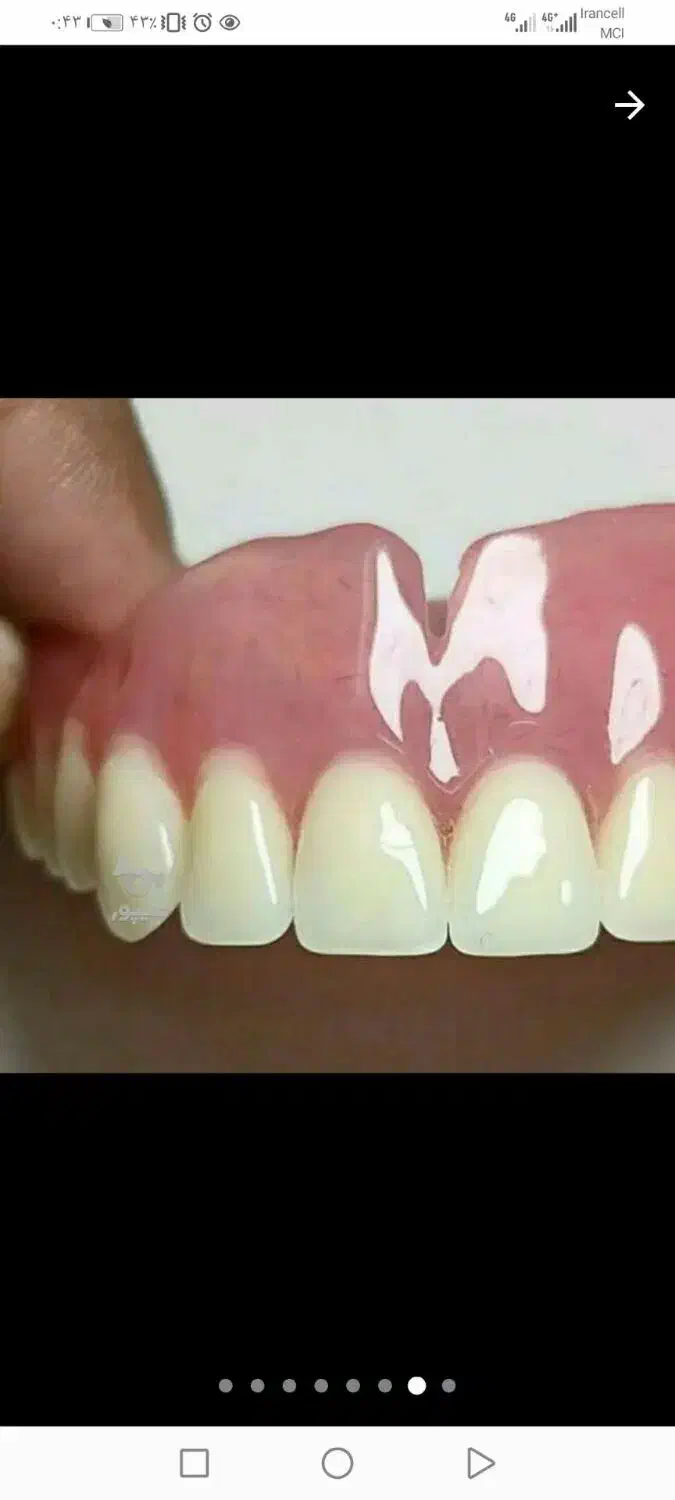 دندانسازی ساخت دندان مصنوعی متحرک باضمانت|آرایشی، بهداشتی، درمانی|مشکیندشت, |دیوار