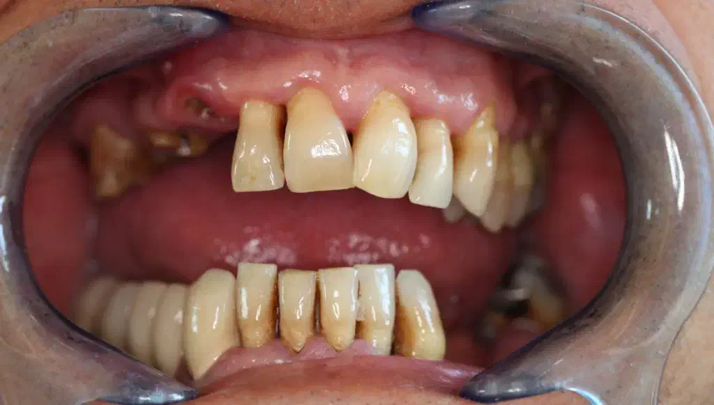 قسطی ایمپلنت و تمام خدمات دندانپزشکی بدون پیش|خدمات آرایشگری و زیبایی|اصفهان, دشتستان|دیوار