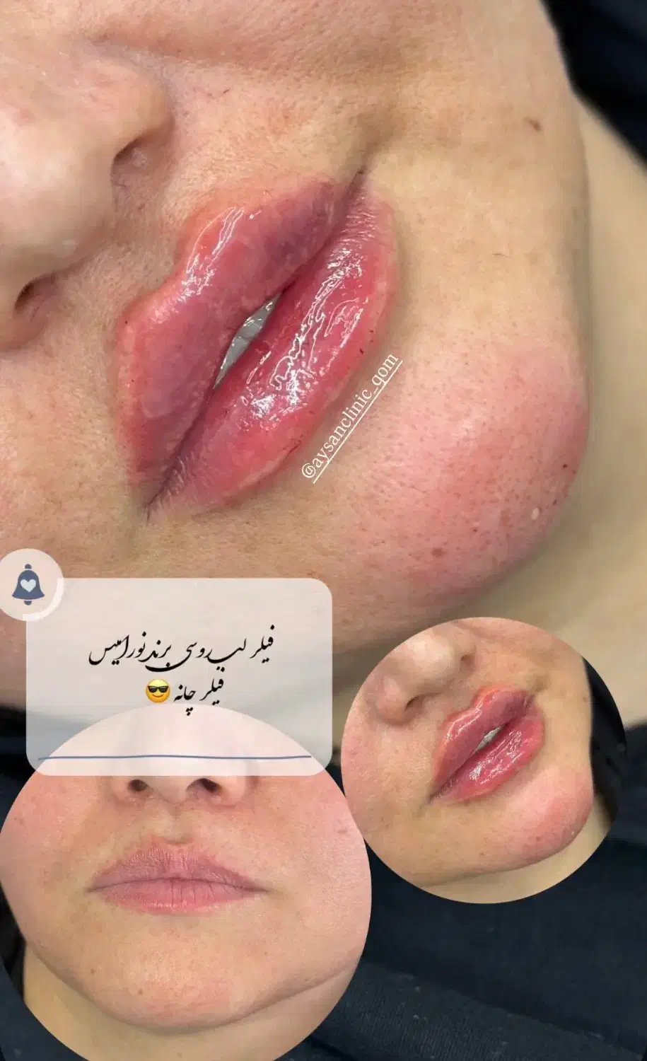 کلینیک زیبایی و لیزر آیسان فیلر و بوتاکس|خدمات آرایشگری و زیبایی|قم, دروازه چوبی|دیوار
