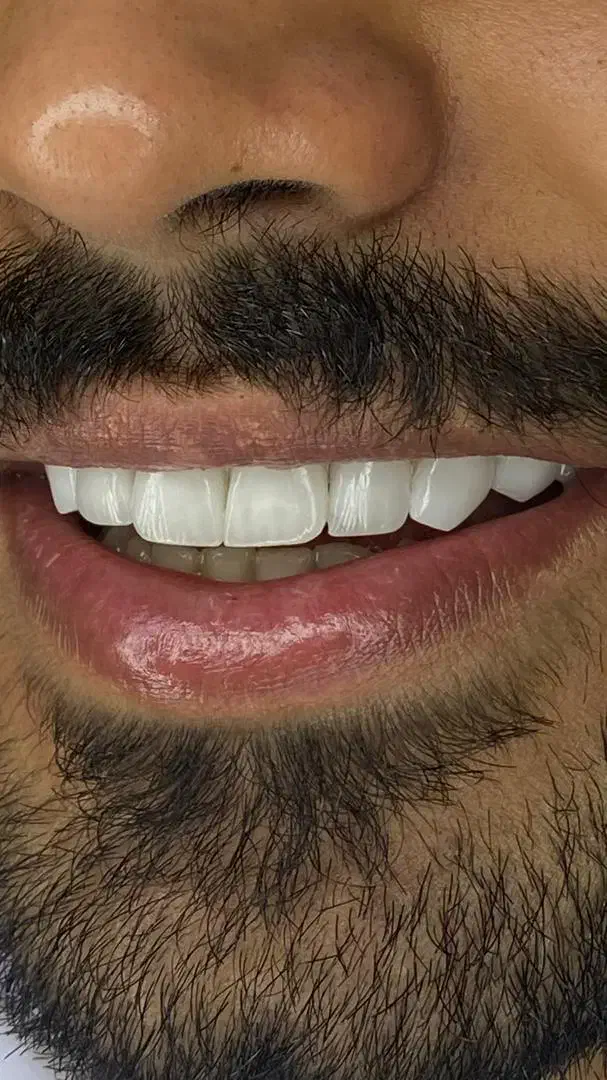 آموزش کامپوزیت ونیر|خدمات آموزشی|شهریار, شهریار|دیوار