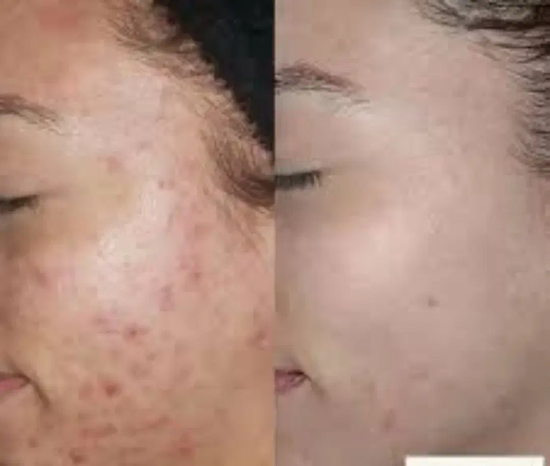 زیبایی صورت.|خدمات آرایشگری و زیبایی|بروجرد, |دیوار