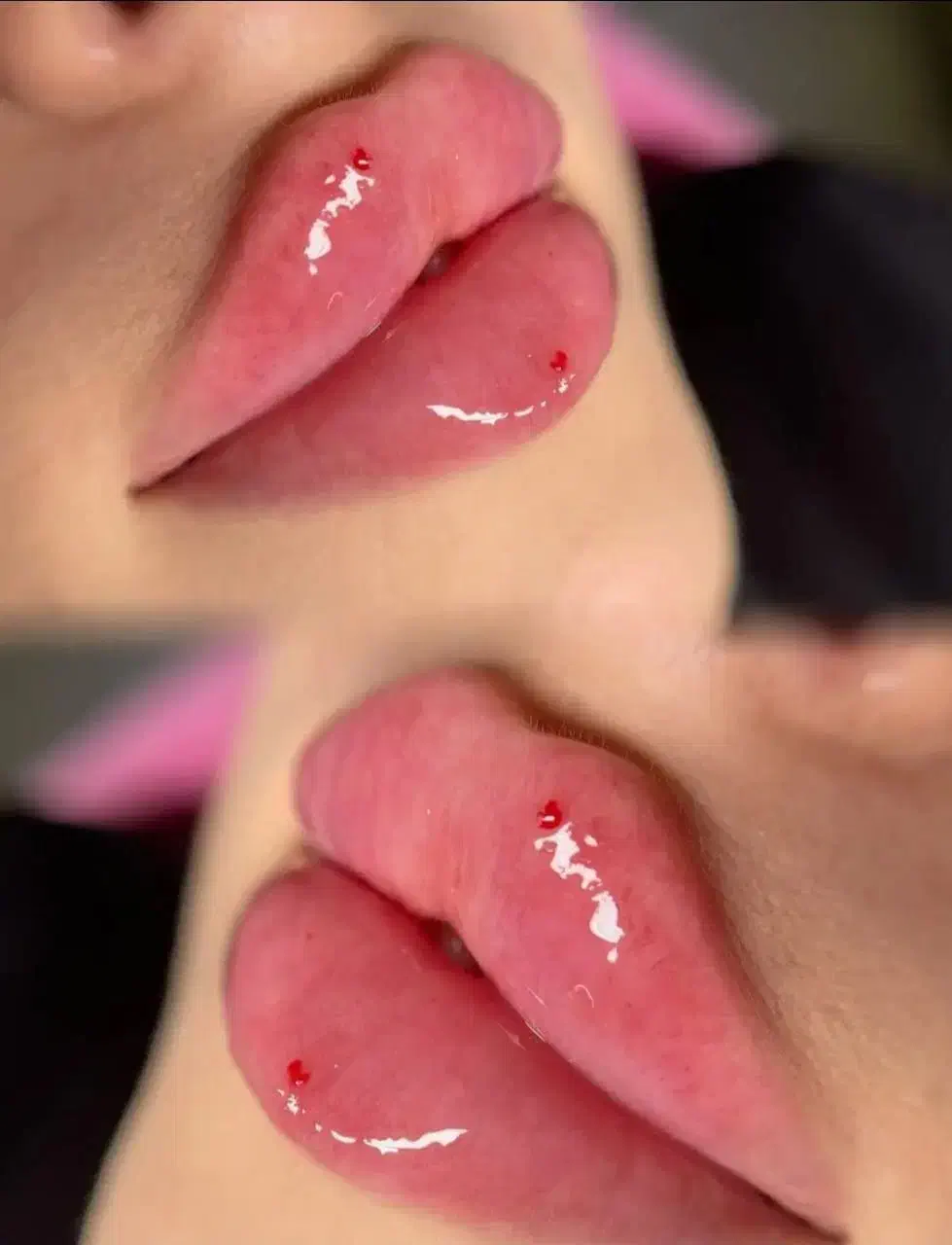 پزشک جراحی بلفا غبغب نخ لیفت کلاژن آنزیم ژل فیلر|خدمات آرایشگری و زیبایی|کرج, گوهردشت|دیوار