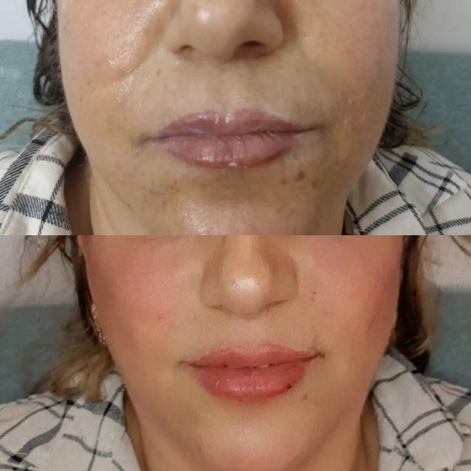 اموزش و خدمات بوتاکس و فیلروفیشیال و فیلر بادی|خدمات آرایشگری و زیبایی|شیراز, کوشک میدان|دیوار