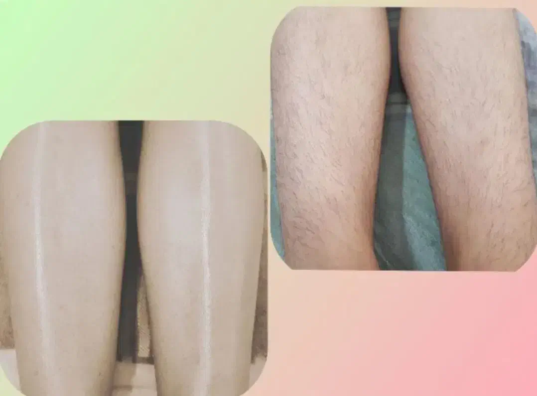 اپیلاسیون تخصصی با سابقه کاری بالا|خدمات آرایشگری و زیبایی|نیشابور, هفده شهریور|دیوار