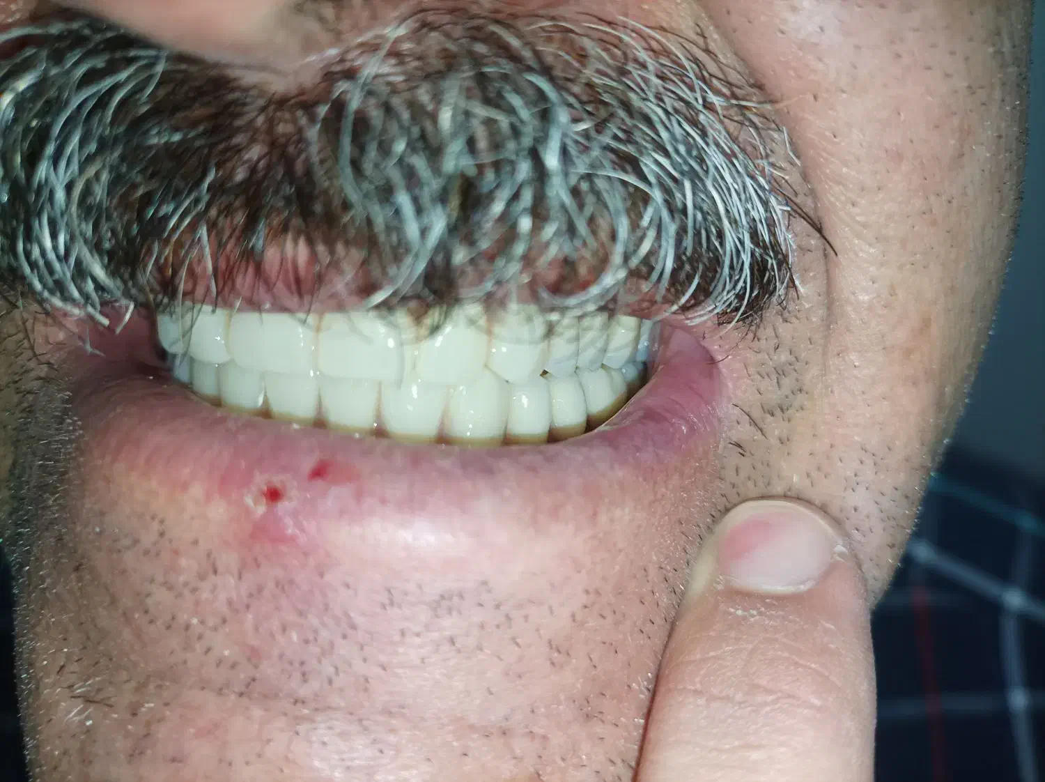 لابراتوار دندانسازی، دندان مصنوعی|آرایشی، بهداشتی، درمانی|تبریز, |دیوار