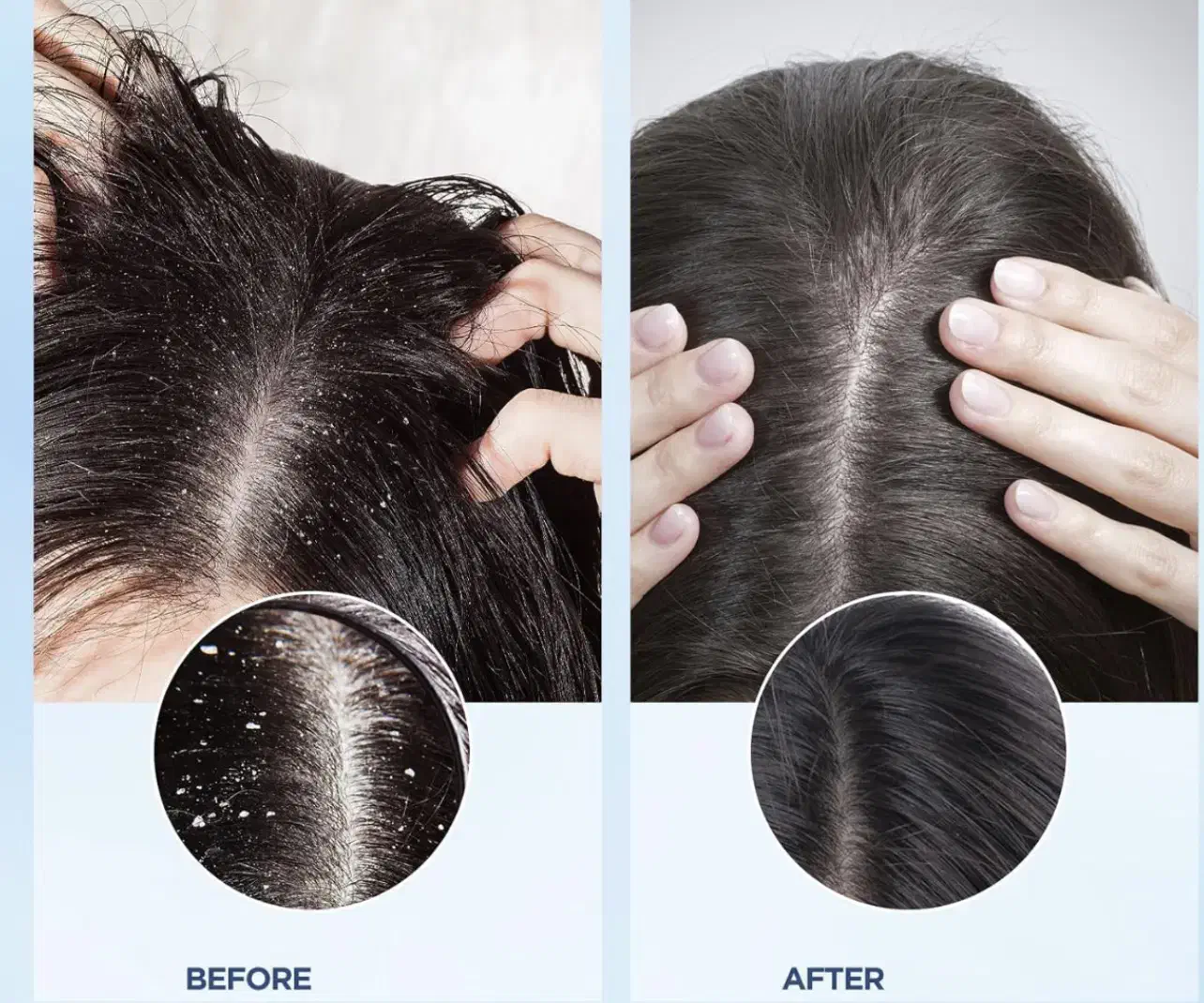 اموزش اسکراب اسکالپ تخصصی با مدرک و خدمات اسکراب|خدمات آرایشگری و زیبایی|تهران, میرداماد|دیوار