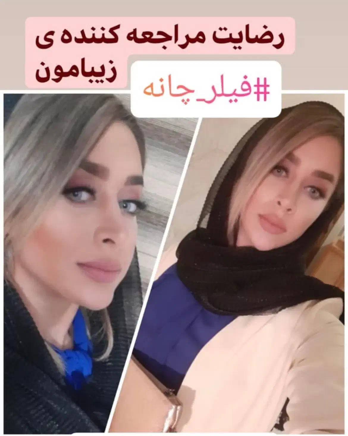 آموزش و خدمات ژل و بوتاکس|خدمات آرایشگری و زیبایی|زابل, |دیوار