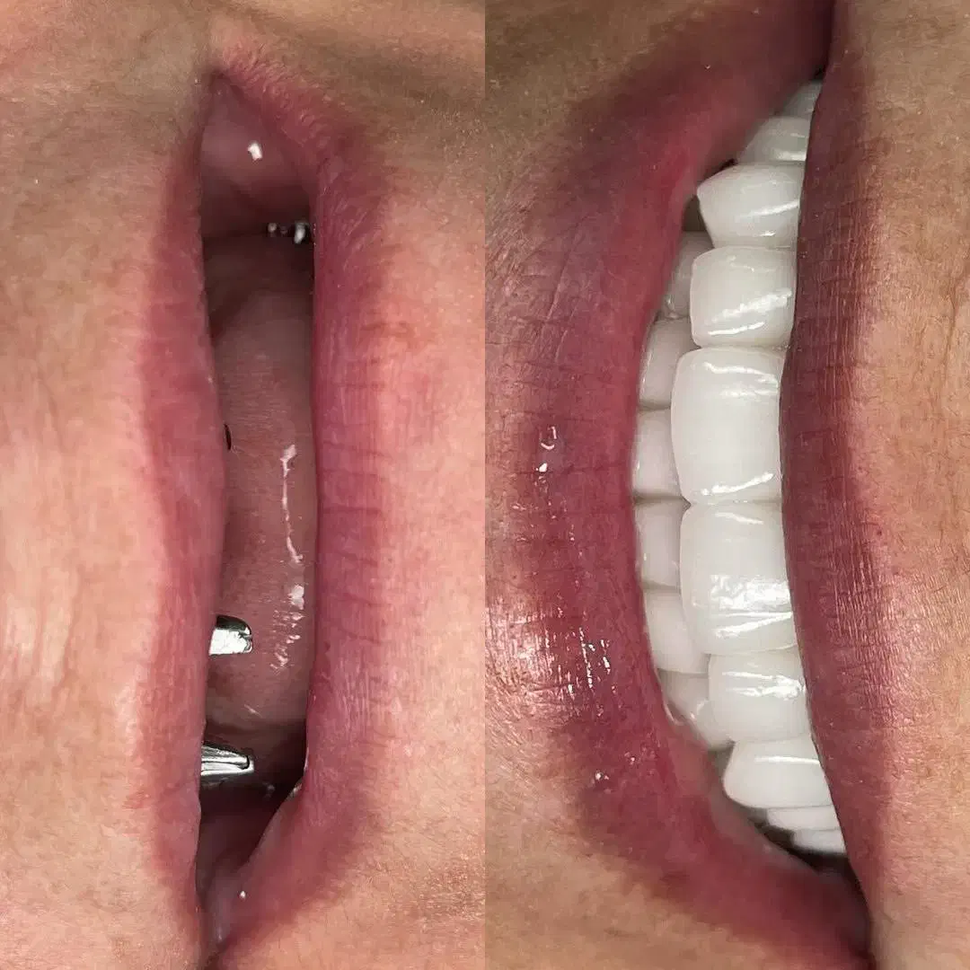 دندانپزشکی ایمپلنت روکش ارتودنسی اقساطی|خدمات آرایشگری و زیبایی|مرند, |دیوار