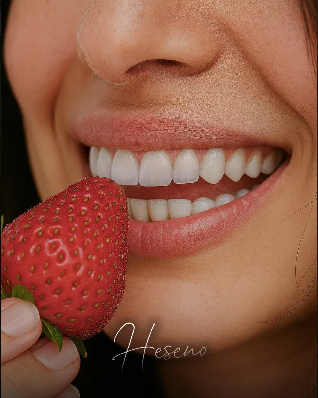 ایمپلنت و لمینیت اقساطی ( فولادشهر )|خدمات آرایشگری و زیبایی|فولادشهر, B2|دیوار