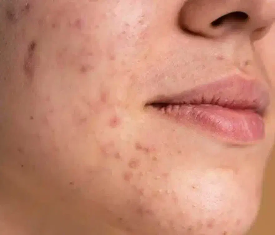 درمان با طب سنتی|خدمات آرایشگری و زیبایی|یاسوج, |دیوار