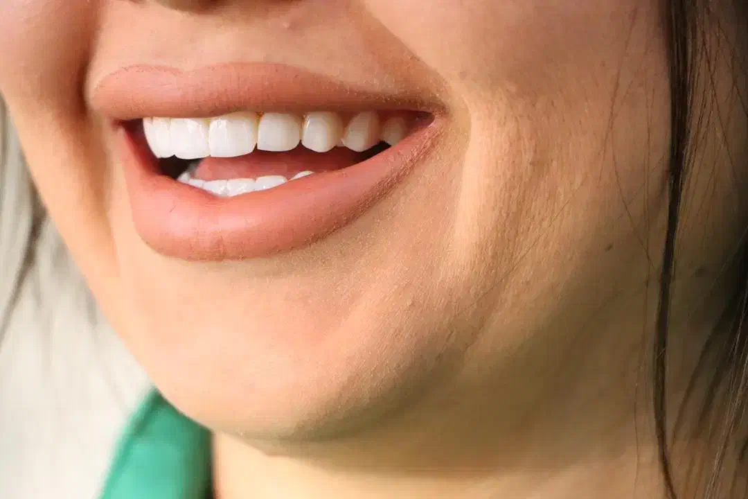 تخفیف ویژه ۲۰٪خدمات دندانپزشکی|خدمات آرایشگری و زیبایی|شیراز, ارم|دیوار