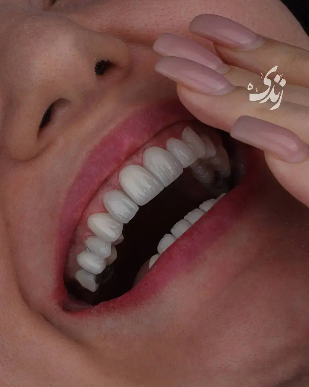 صفرتاصد خدمات دندانپزشکی به صورت اقساطی|خدمات آرایشگری و زیبایی|بوشهر, |دیوار