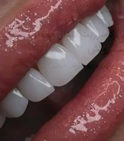 مدل دندان|فعالیت داوطلبانه|اهواز, اهواز|دیوار