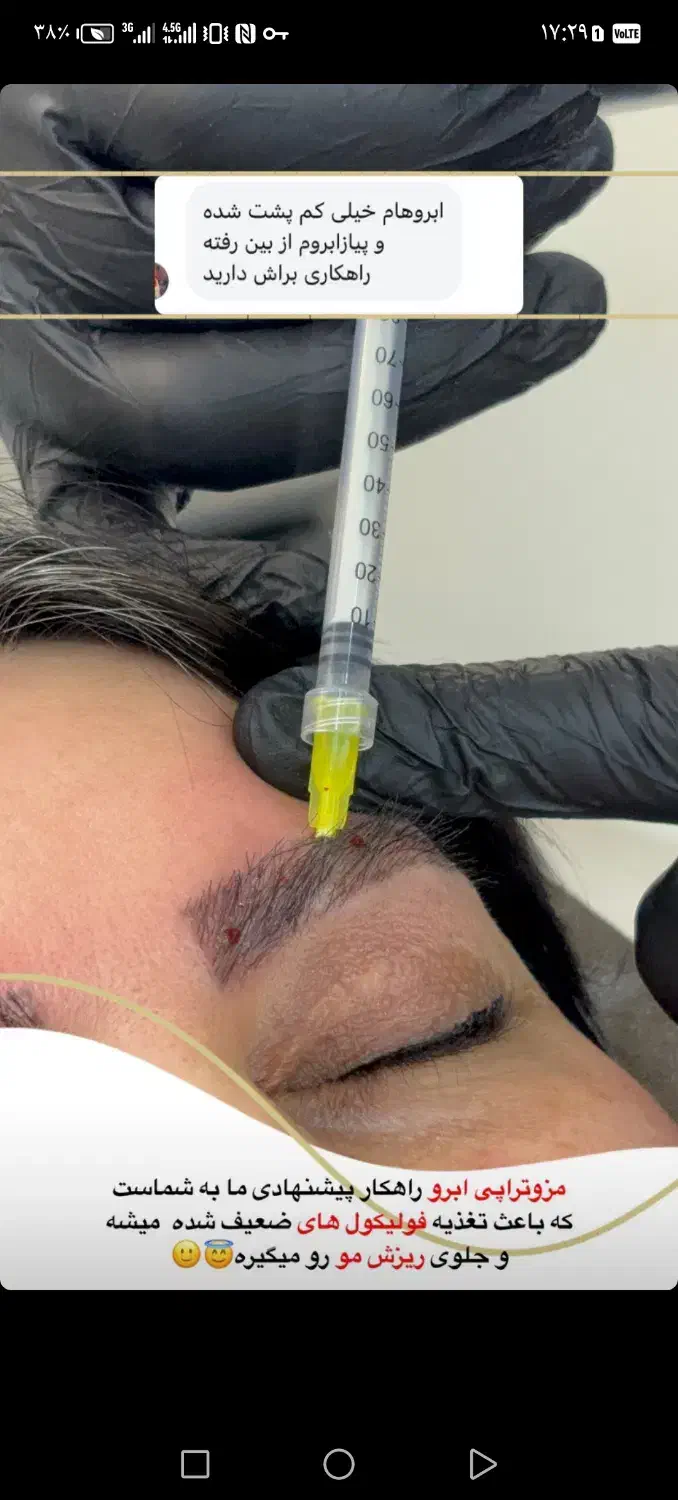 اموزش لیزر. مزوتراپی. کربوکسی تراپی|خدمات آموزشی|کرمان, |دیوار