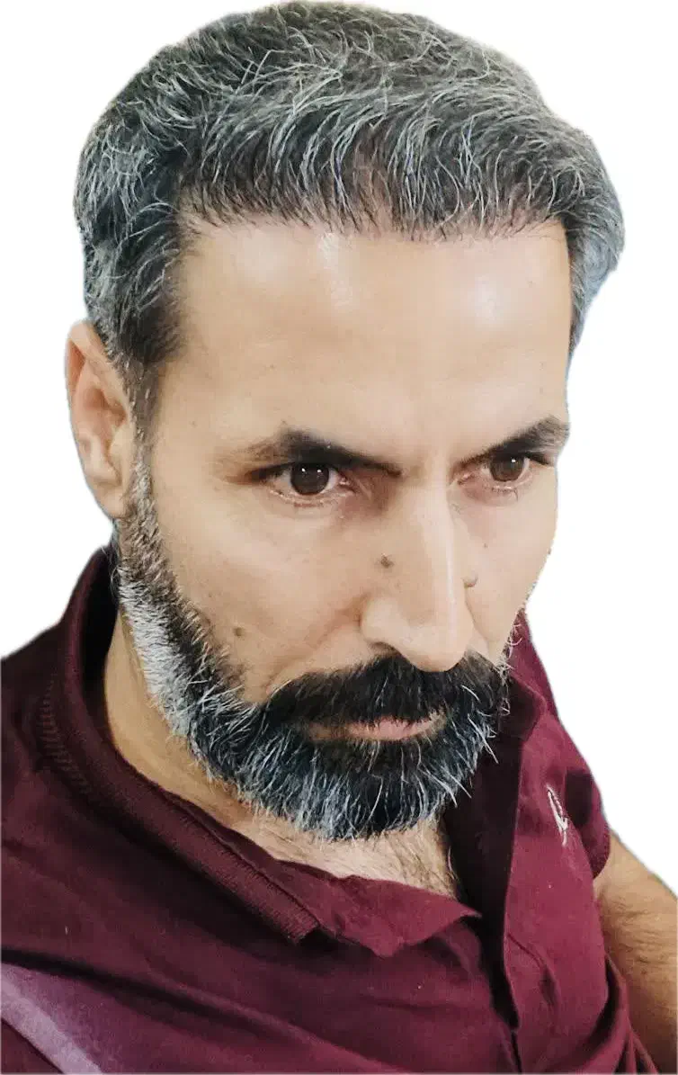 کاشت مو و مزوتراپی اقساط|خدمات آرایشگری و زیبایی|مشهد, احمدآباد|دیوار