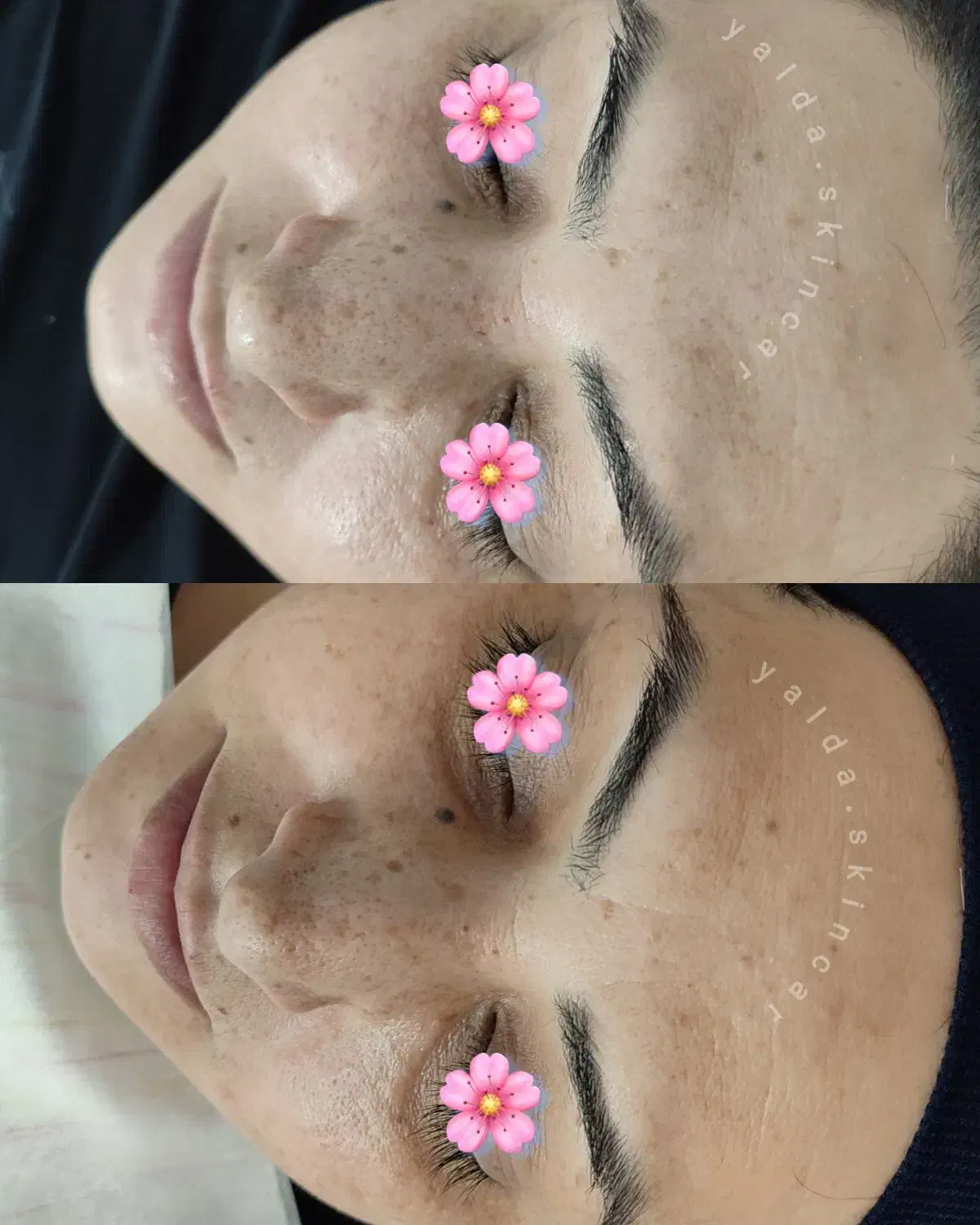 ارائه خدمات تخصصی پوست برای خانم ها|خدمات آرایشگری و زیبایی|تربت جام, المهدی|دیوار