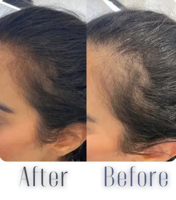 در افسریه ژل و فیلر مزوتراپی چربی سوز غبغب جوانساز|خدمات آرایشگری و زیبایی|تهران, افسریه شمالی|دیوار