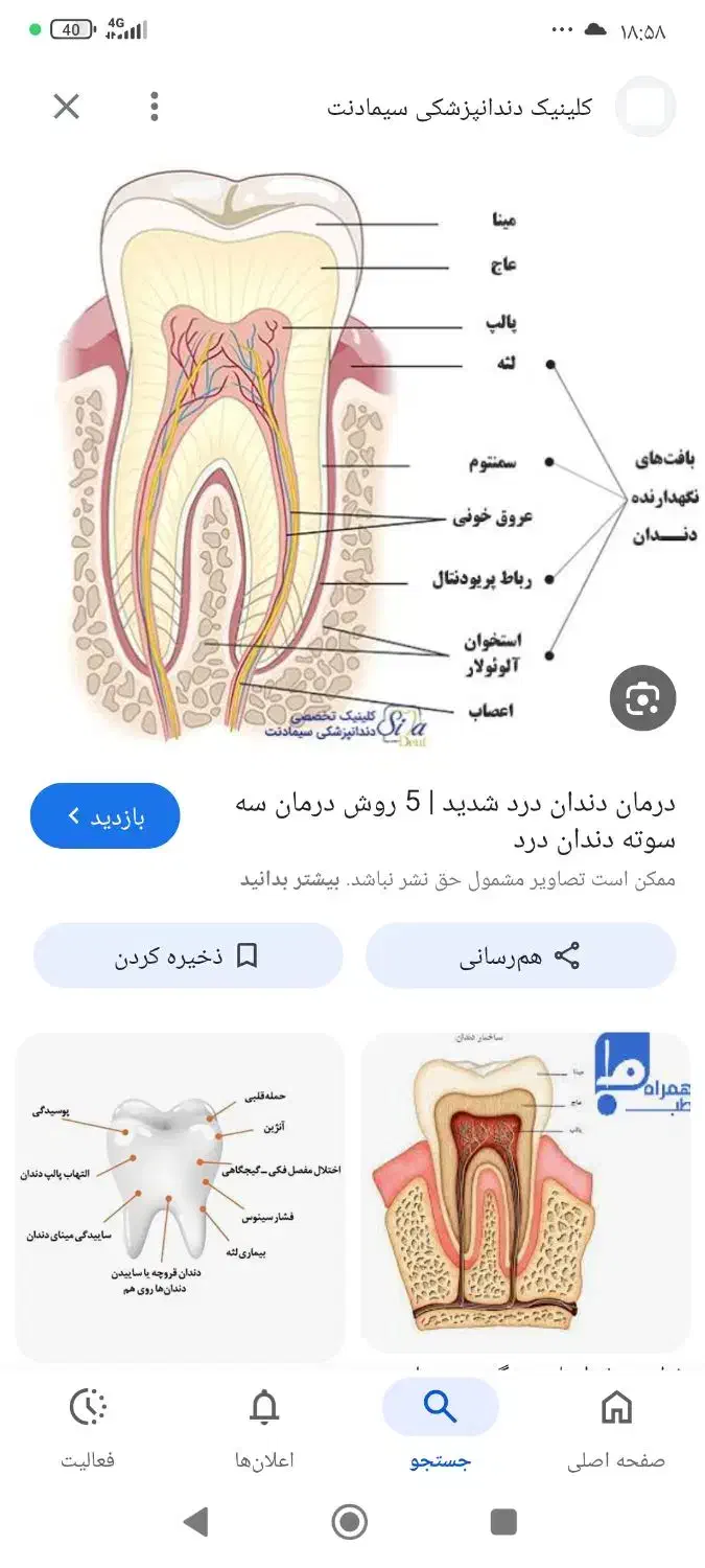 دندان مصنوعی|فعالیت داوطلبانه تحقیقاتی|نیشابور, بار|دیوار