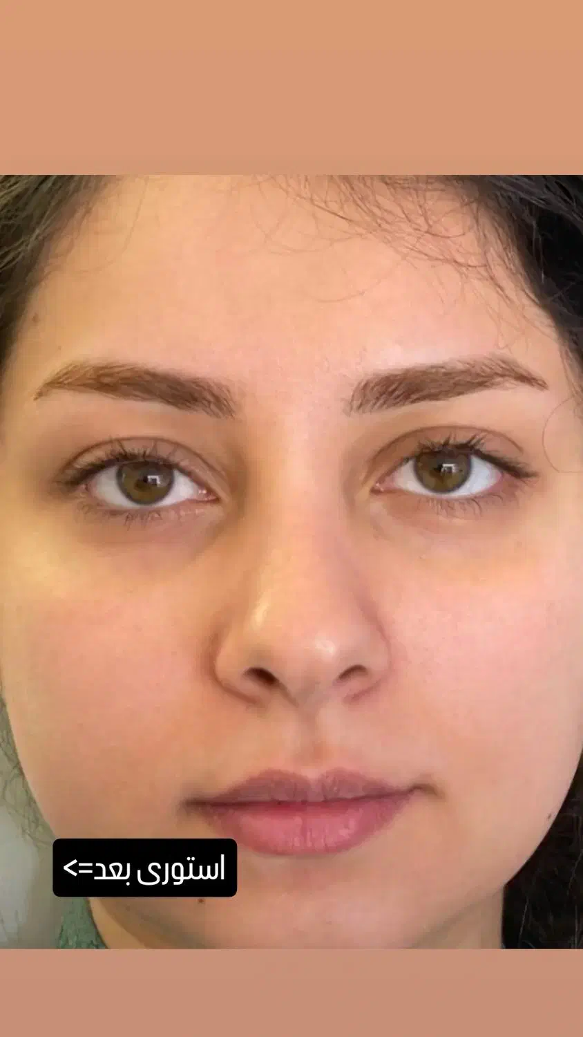 سالن زیبایی.اموزش.خدمات.|خدمات آرایشگری و زیبایی|کرمانشاه, |دیوار