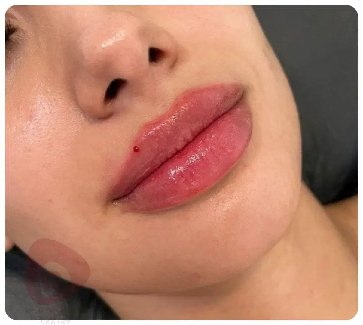 درمان و خدمات زیبایی|خدمات آرایشگری و زیبایی|فردیس, فردیس|دیوار