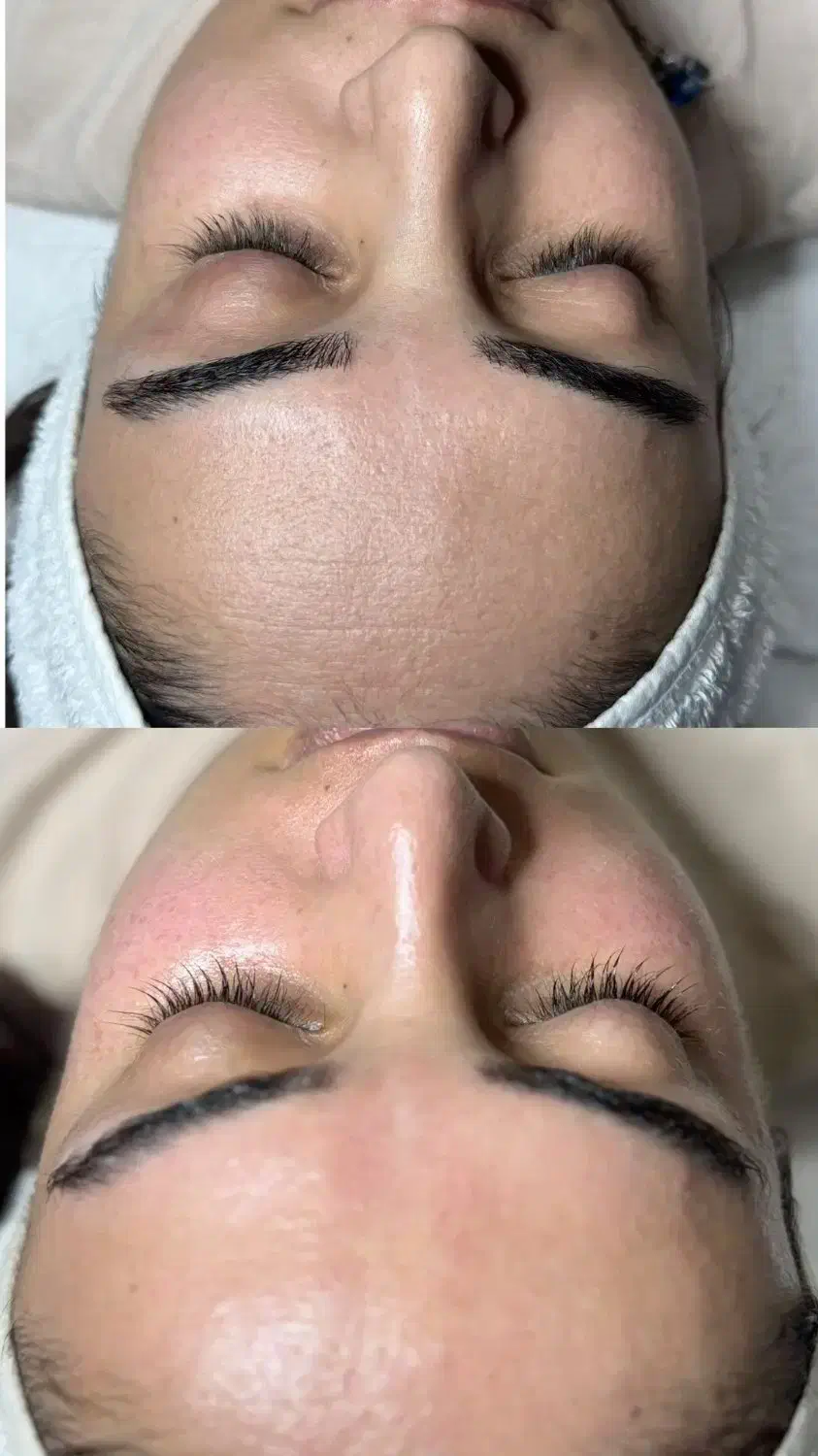 فیشال تخصصی و حرفه ای 50% تخفیف به مدت محدود|خدمات آرایشگری و زیبایی|شیراز, رحمتآباد|دیوار